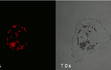 image of Visualizing lipid molecules